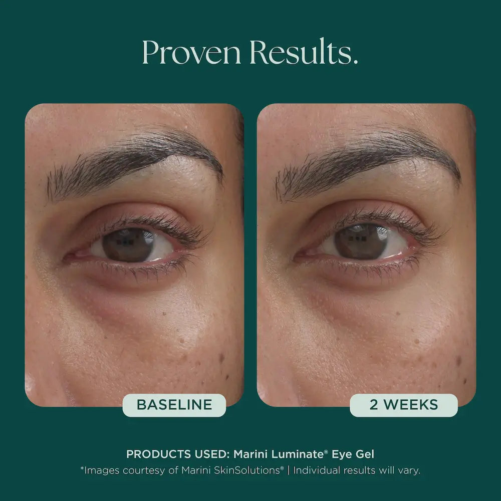 Marini SkinSolutions Marini Luminate® Eye Gel 0.5 oz | Skin Elite
