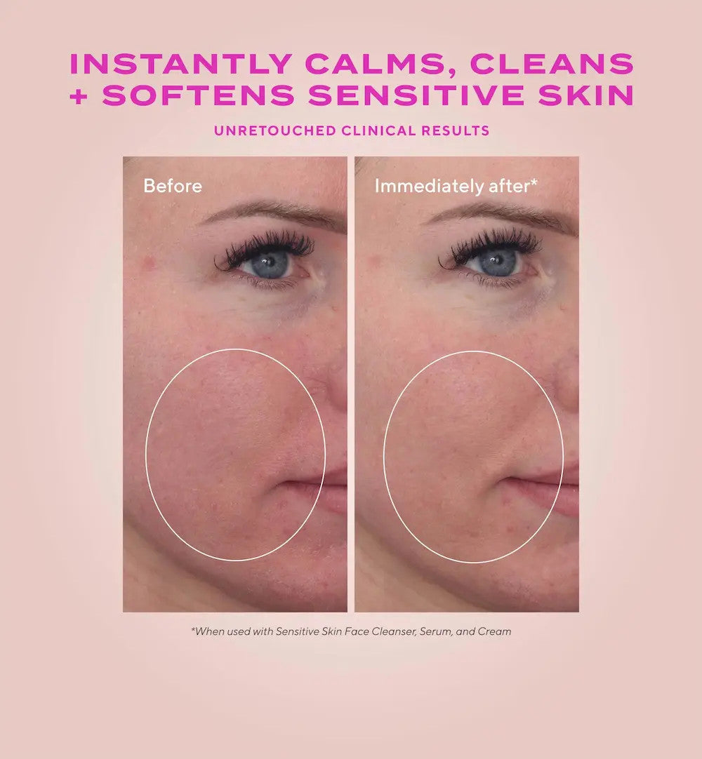 Murad Heartleaf Soothing Cleanser 5 fl oz- before and after