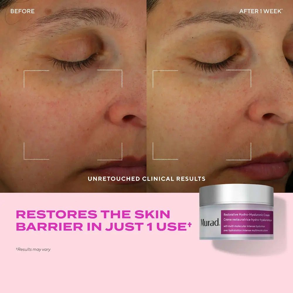 Murad Restorative Hydro-Hyaluronic Cream 1.7 fl oz- before and after