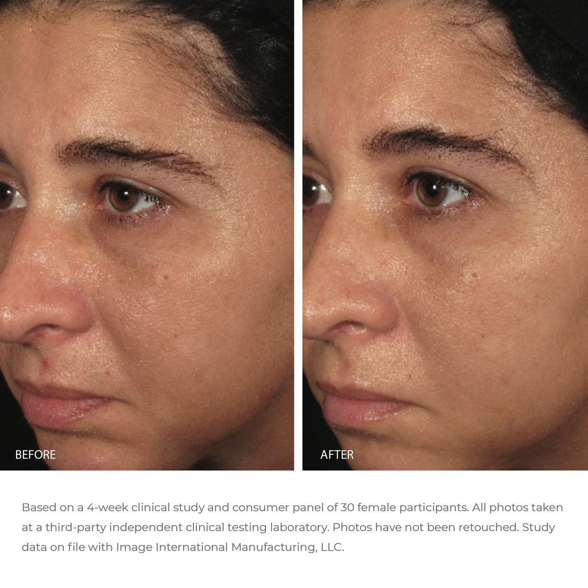 IMAGE Ormedic Balancing Biopeptide Crème 2 oz - SkinElite - before and after