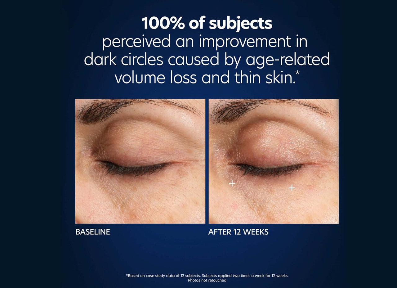 PCA Skin Microneedle Eye Patches - set of 4 - SkinElite - before and after 2