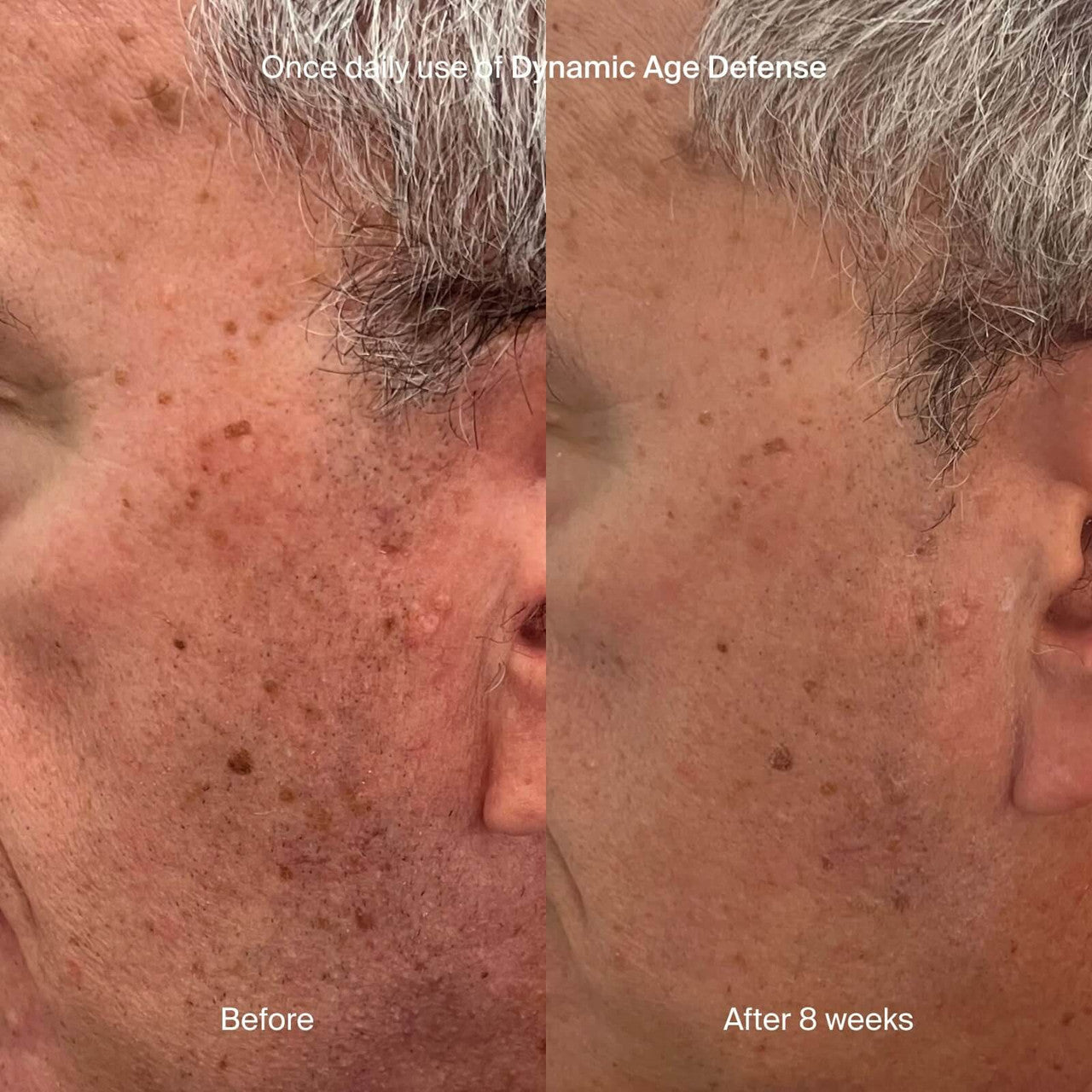 Pavise Dynamic Age Defense 1 oz - SkinElite - before and after 1