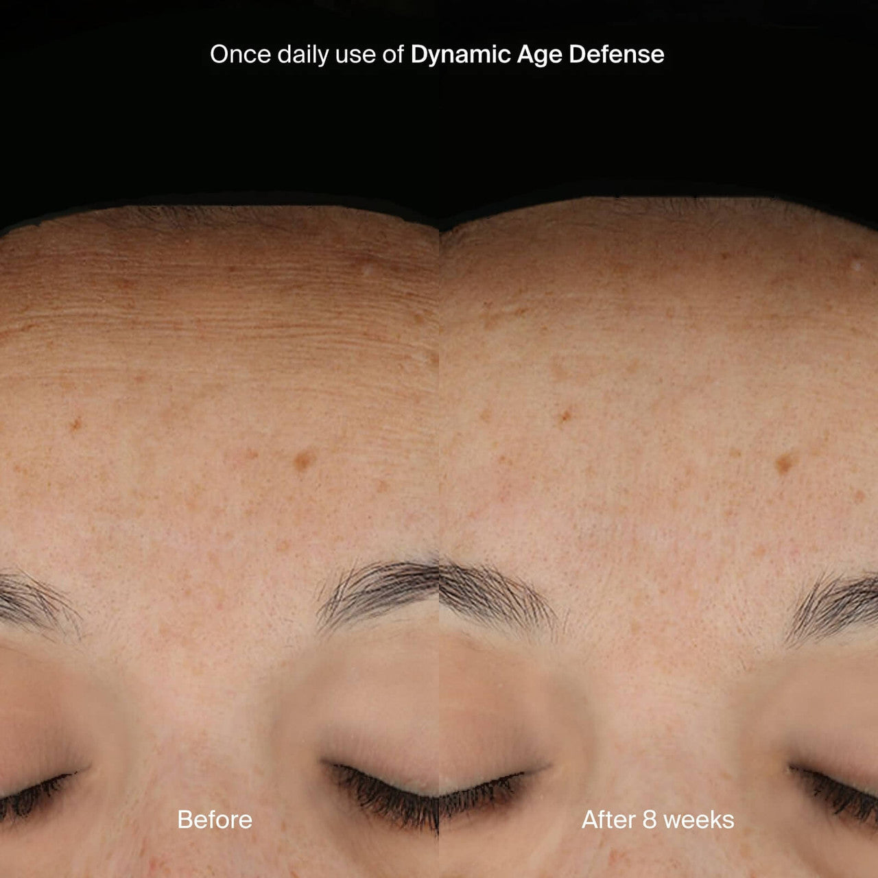 Pavise Dynamic Age Defense 1 oz - SkinElite - before and after 2