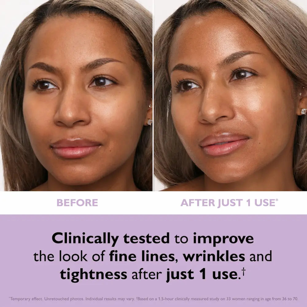 Peter Thomas Roth Instant FIRMx® Collagen Tightening Face Patches 12 Patches before and after