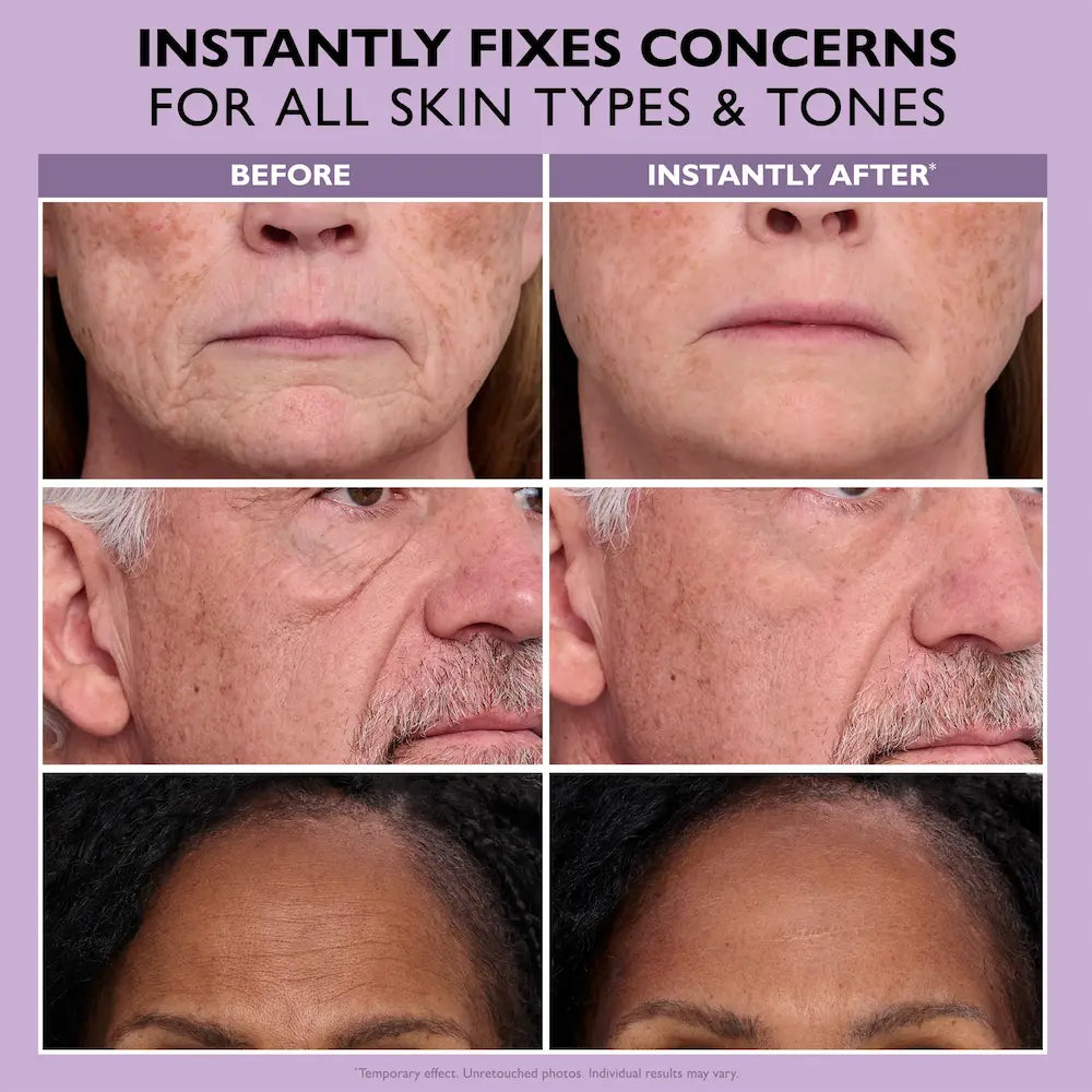 Peter Thomas Roth Instant FIRMx® Temporary Face Tightener Easy-Wear Formula 1.35 oz before and after 1
