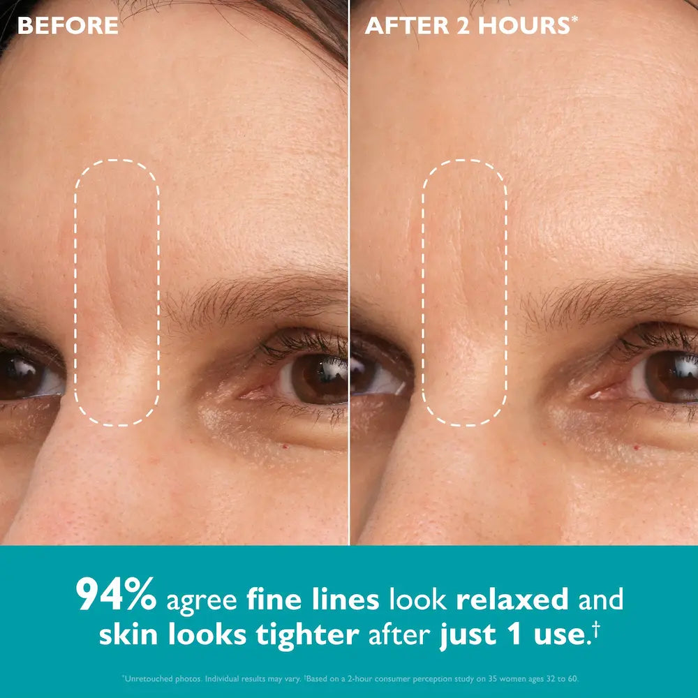 Peter Thomas Roth Peptide Skinjection Peptide Infused Face + Eye Tape before and after between eyes