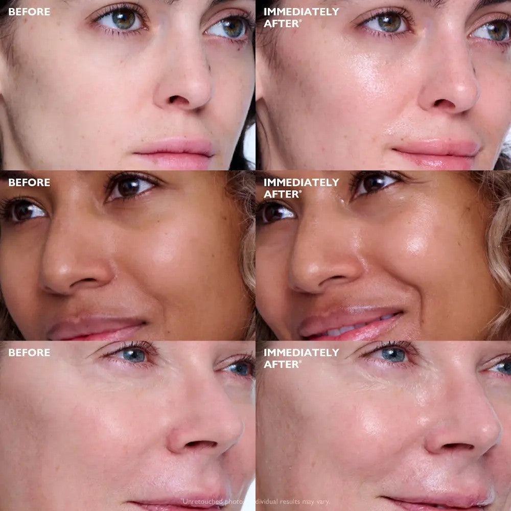 Peter Thomas Roth Collagen Skinjection Plumping & Firming Serum 1 fl oz befores and afters