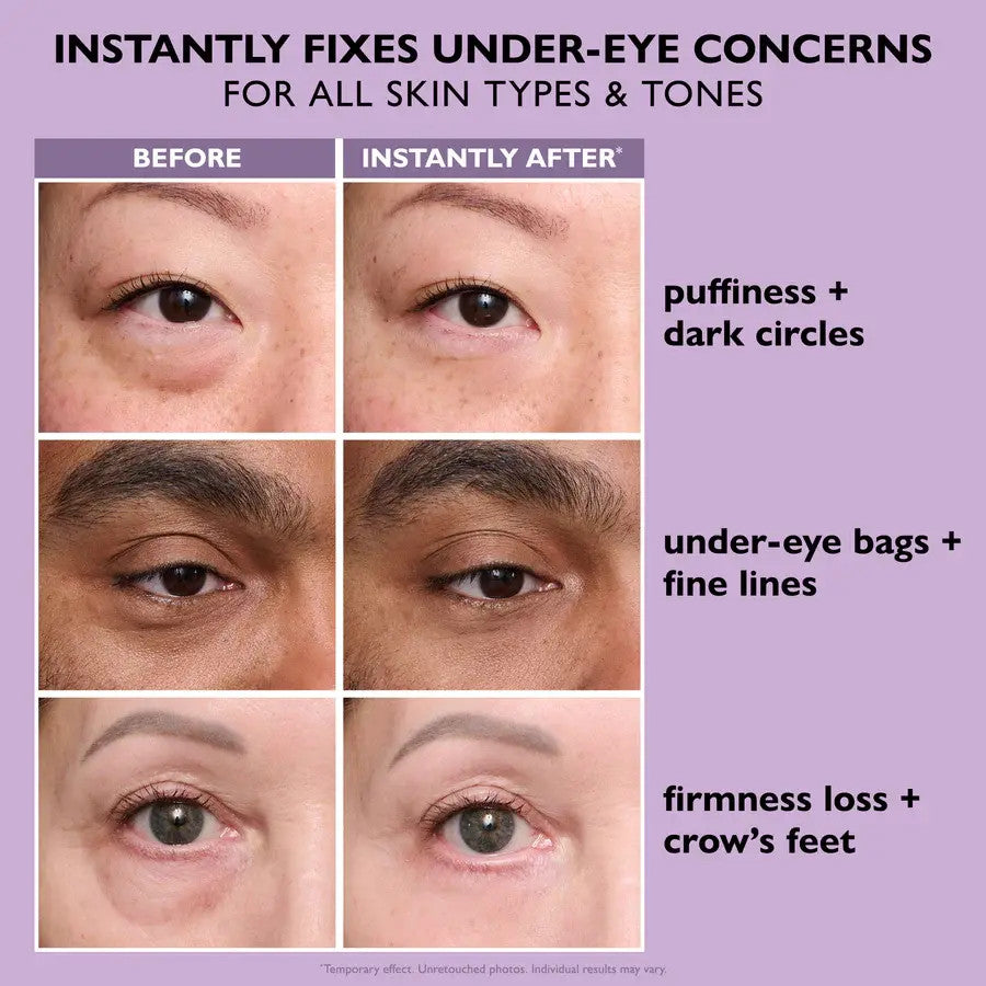 Peter Thomas Roth Instant FIRMx Eye Temporary Eye Tightener Easy-Wear Formula 0.67 fl oz concerns