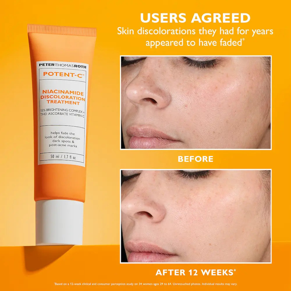 Peter Thomas Roth Potent-C Niacinamide Discoloration Treatment 1.7 fl oz_before and after