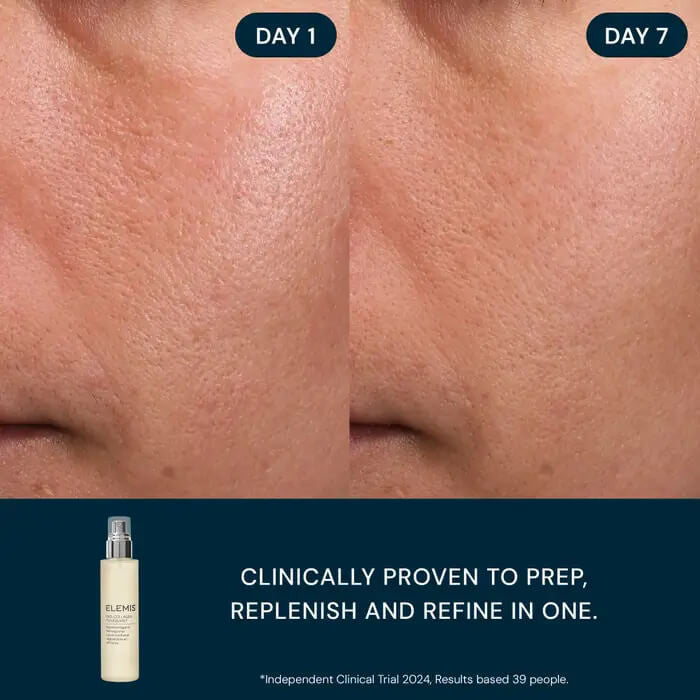 Elemis Pro-Collagen Toning Mist - Skin Elite - before and after
