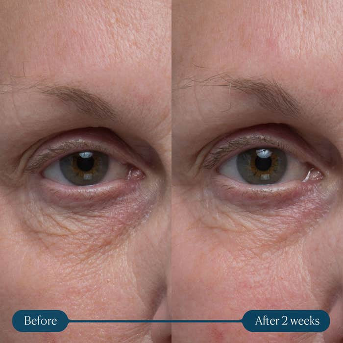 Elemis Pro-Collagen Vitality Eye Cream 0.5 fl oz - SkinElite - before and after