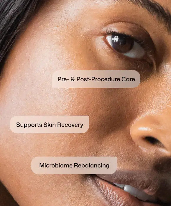 Revision Procedure Prep & Recover Regimen model