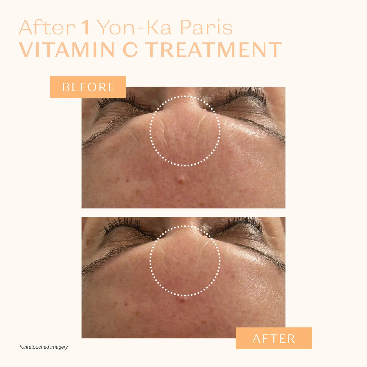 Yon-Ka Paris Serum Vitamine C - Skin Elite - before and after 1