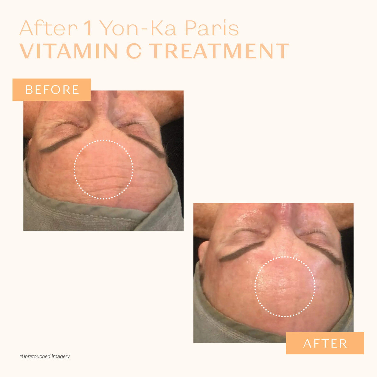 Yon-Ka Paris Serum Vitamine C - Skin Elite - before and after 2
