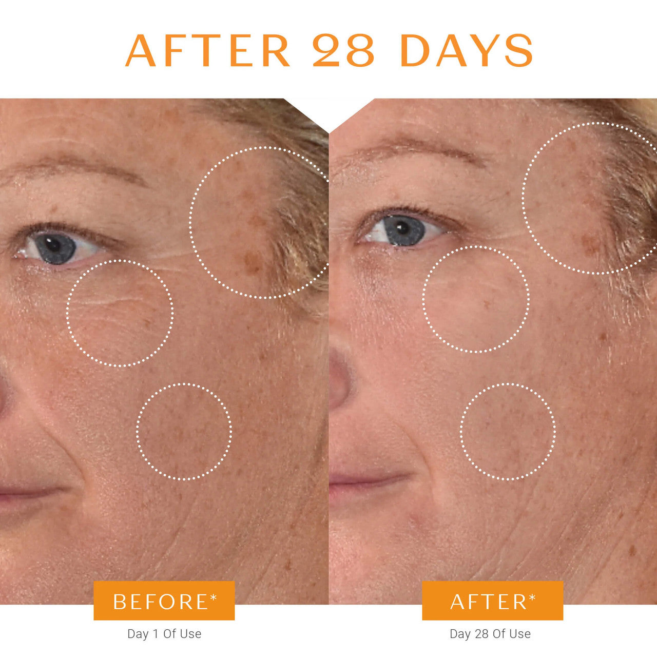 Yon-Ka Paris Serum Vitamine C - Skin Elite - before and after 3
