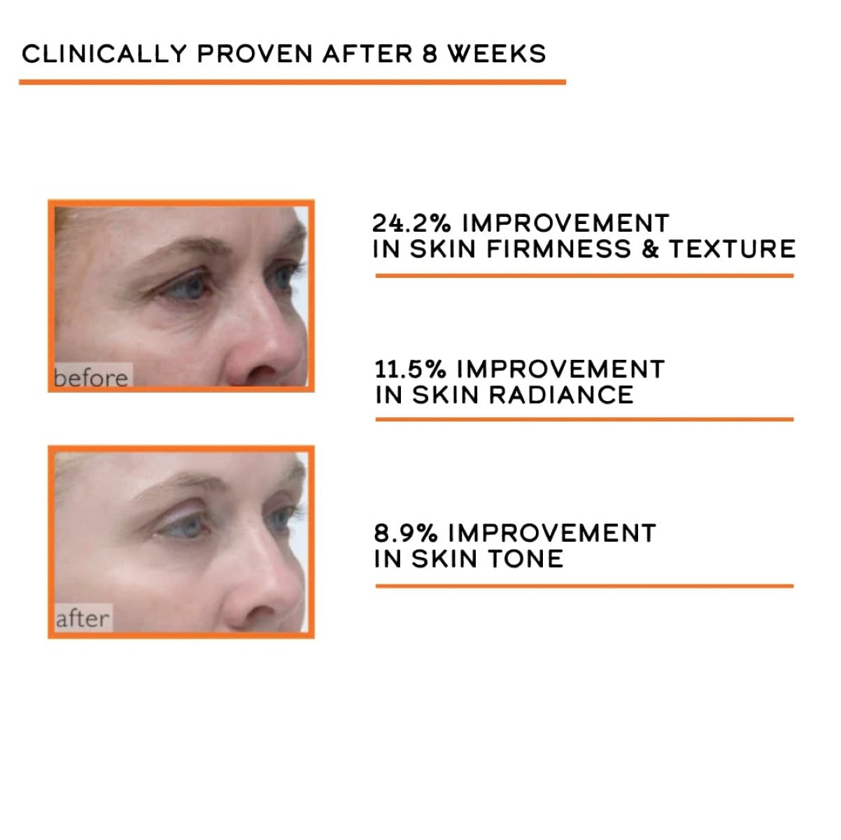 DCL Vitamin C Night Booster 30 - 1 oz - SkinElite - results