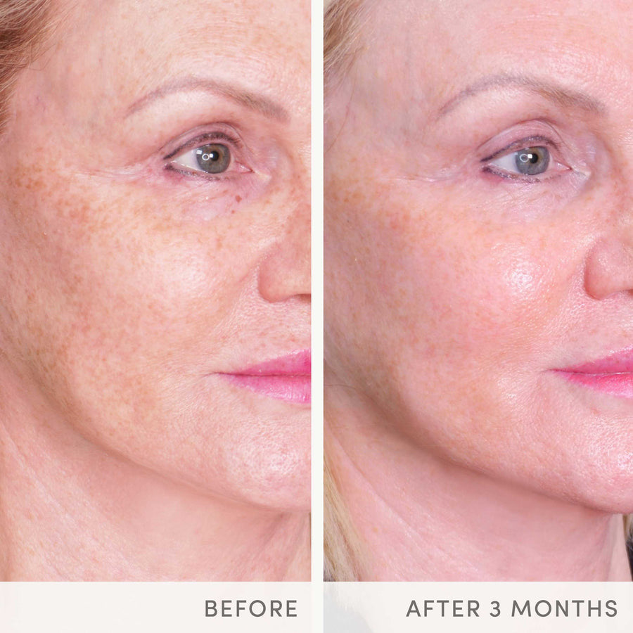 Jane Iredale Skin Ultimate - 168 capsules - SkinElite - results