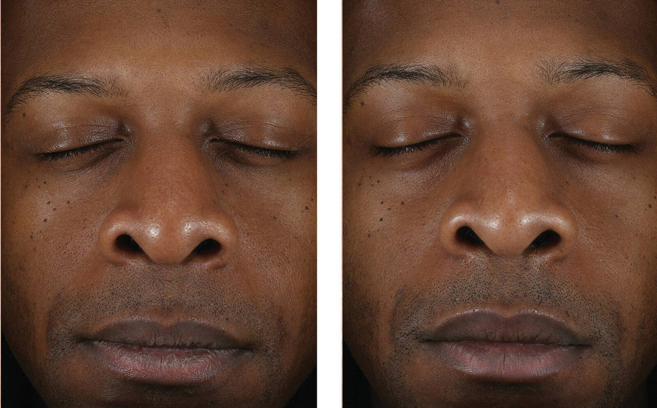 SkinBetter Solo Hydrating Defense Men 1.7 fl oz - SkinElite - before and after 2