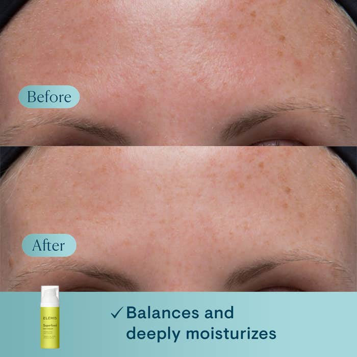 Elemis Superfood Day Cream 1.6 fl oz - SkinElite - before and after
