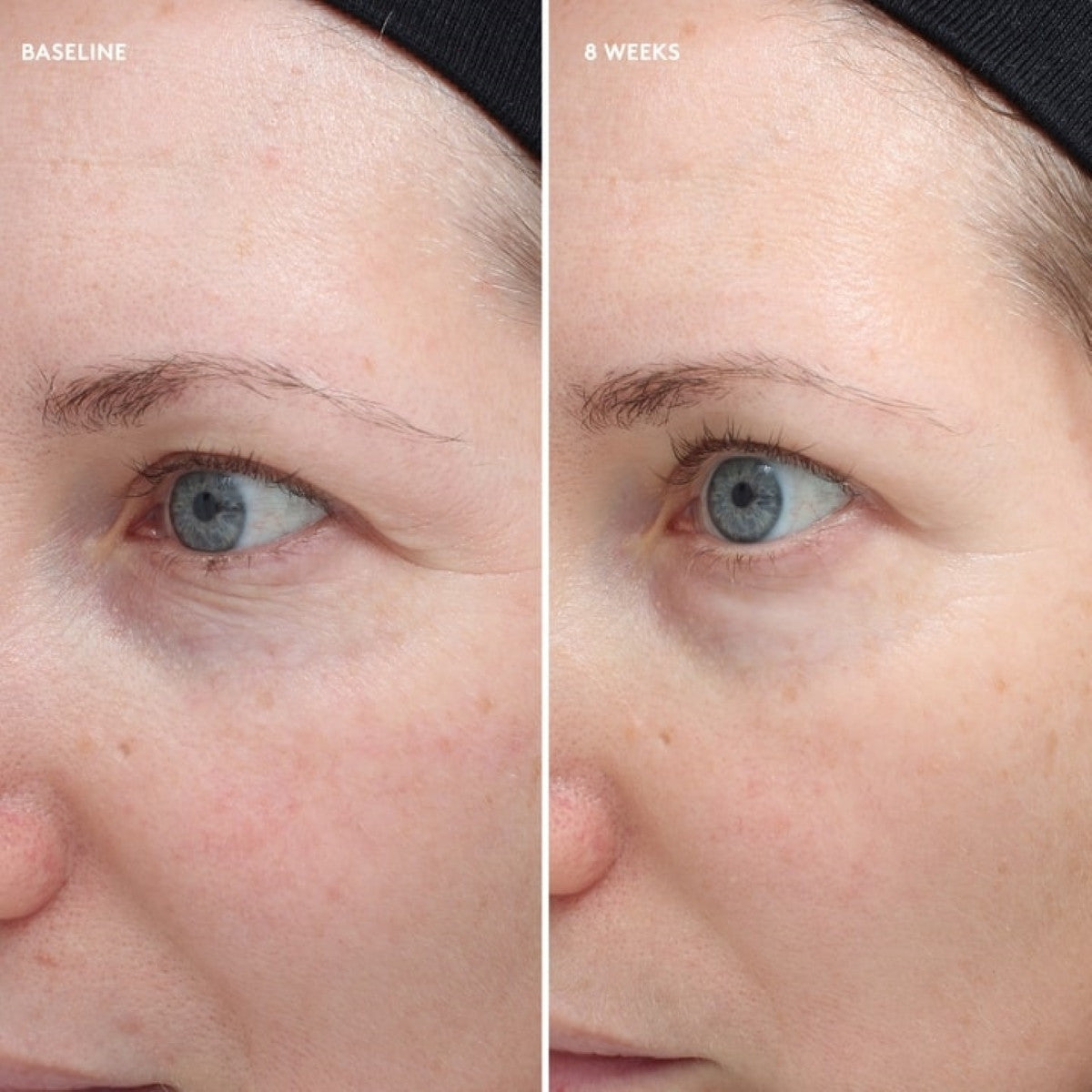 Colorescience Total Eye® Firm & Repair Cream 0.6 fl oz - SkinElite - before and after 1