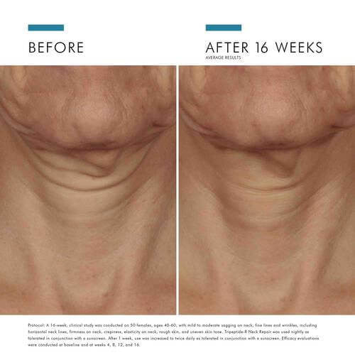 SkinCeuticals Tripeptide-R Neck Repair 1.7 fl oz - SkinElite - before and after