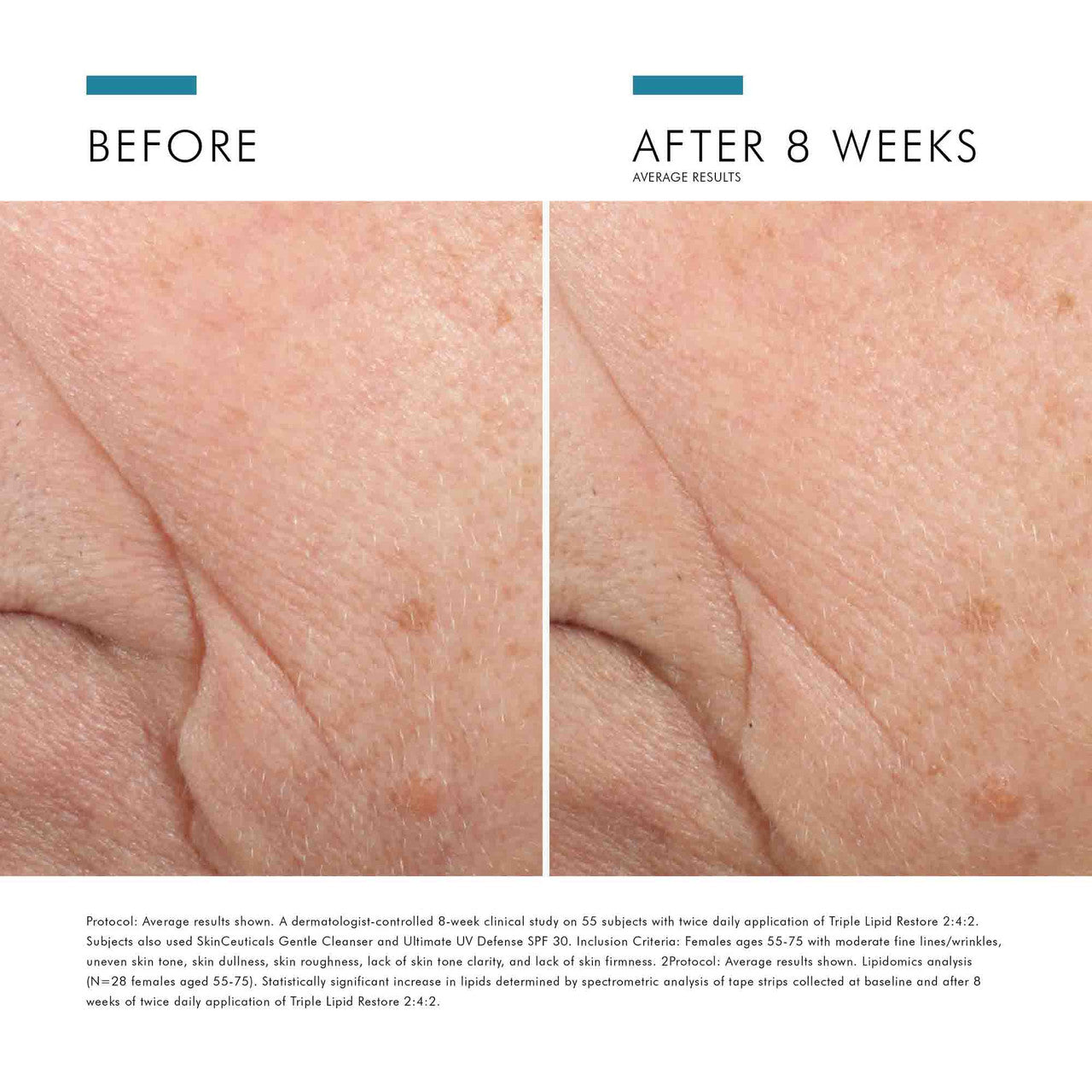 SkinCeuticals Triple Lipid Restore 2:4:2 - 1.6 oz - SkinElite - before and after