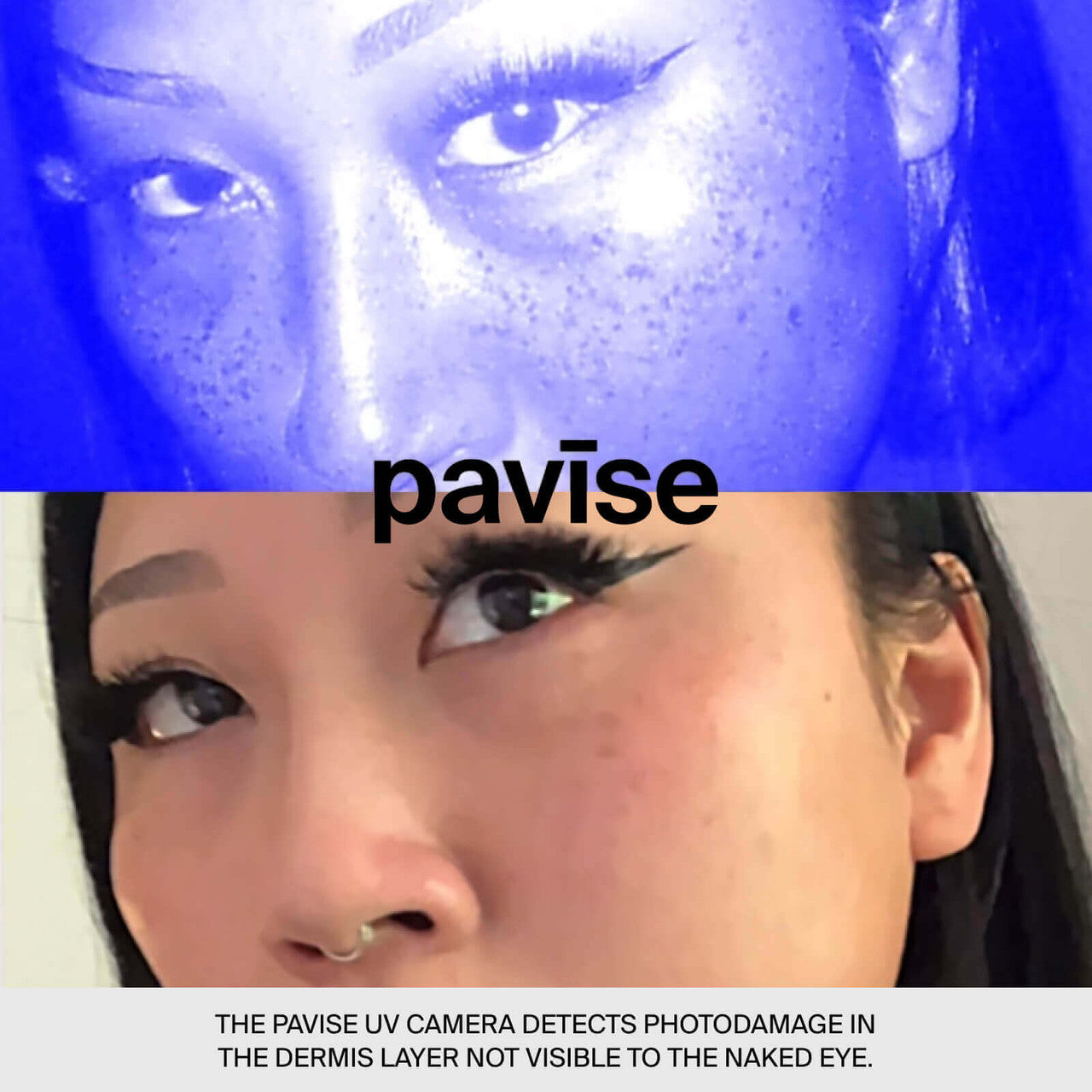 Pavise UV Camera - SkinElite - photo results