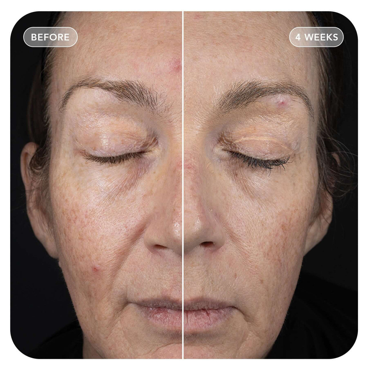 IMAGE VOL.U.LIFT™ GLP-1 4D Skin Rebound Complex