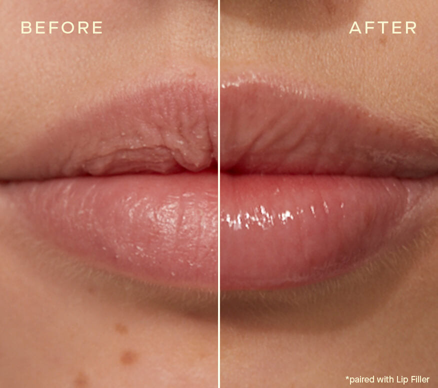 Ourself Lip Conditioner with Vitamin E 0.19 fl oz - Clear - SkinElite - before and after 2
