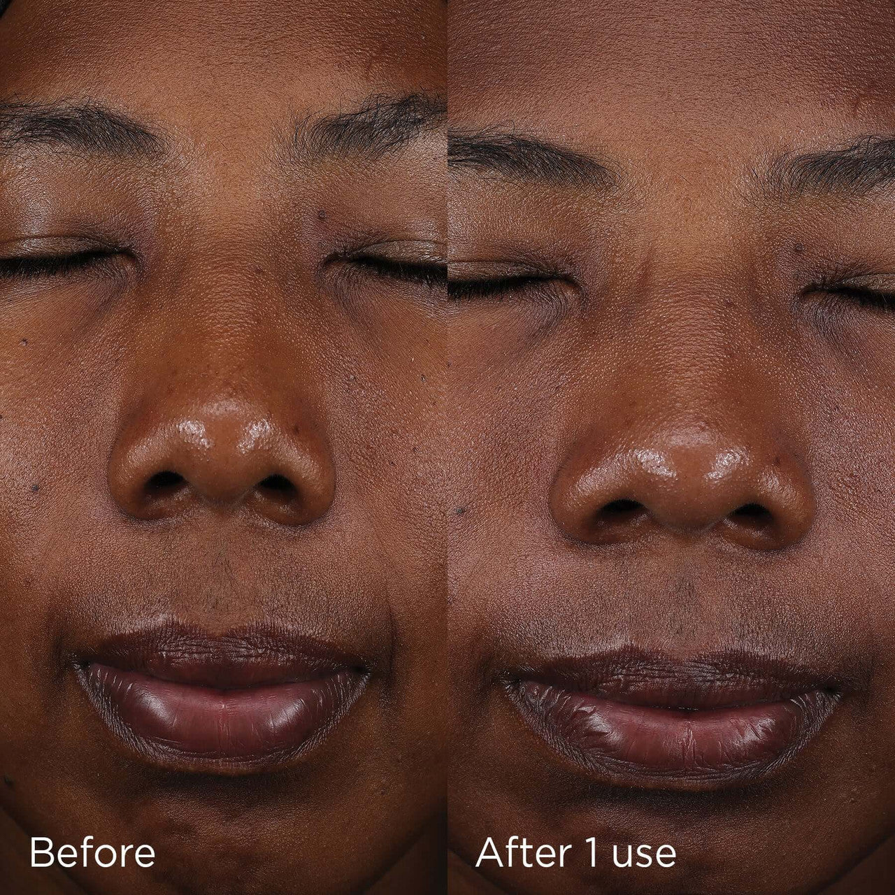 IMAGE DAILY PREVENTION pure mineral tinted moisturizer SPF 30 - 2.6 fl oz - SkinElite - before and after
