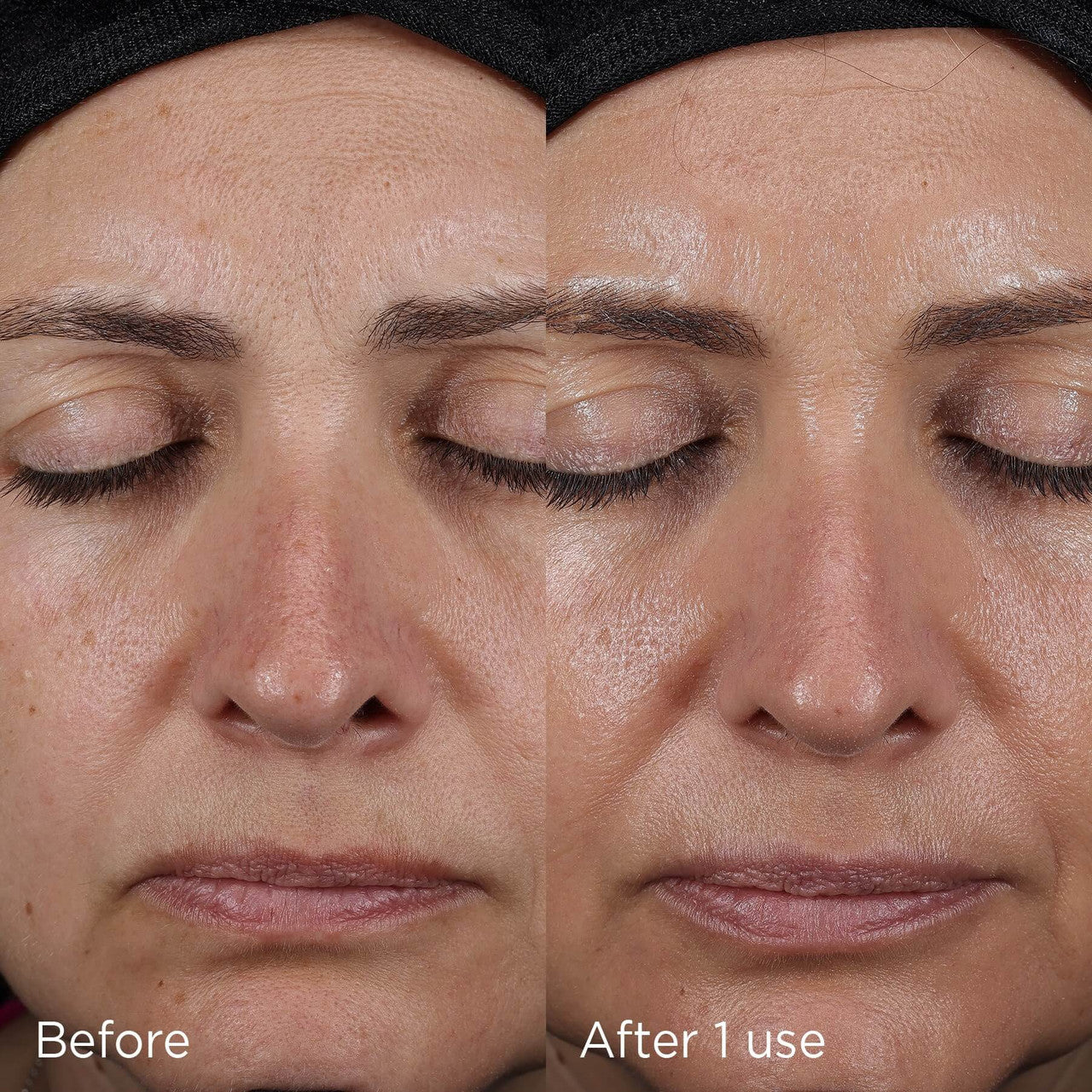 IMAGE DAILY PREVENTION advanced smartblend mineral moisturizer SPF 75 - 1.7 fl oz - SkinElite - before and after