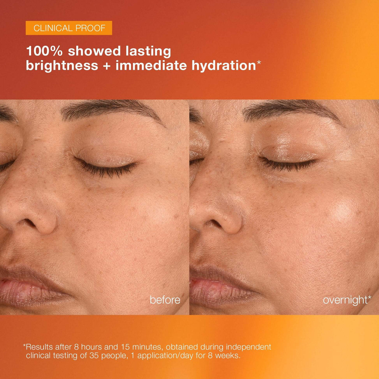 Dermalogica BioLumin-C Night Restore Serum | Skin Elite - before and after