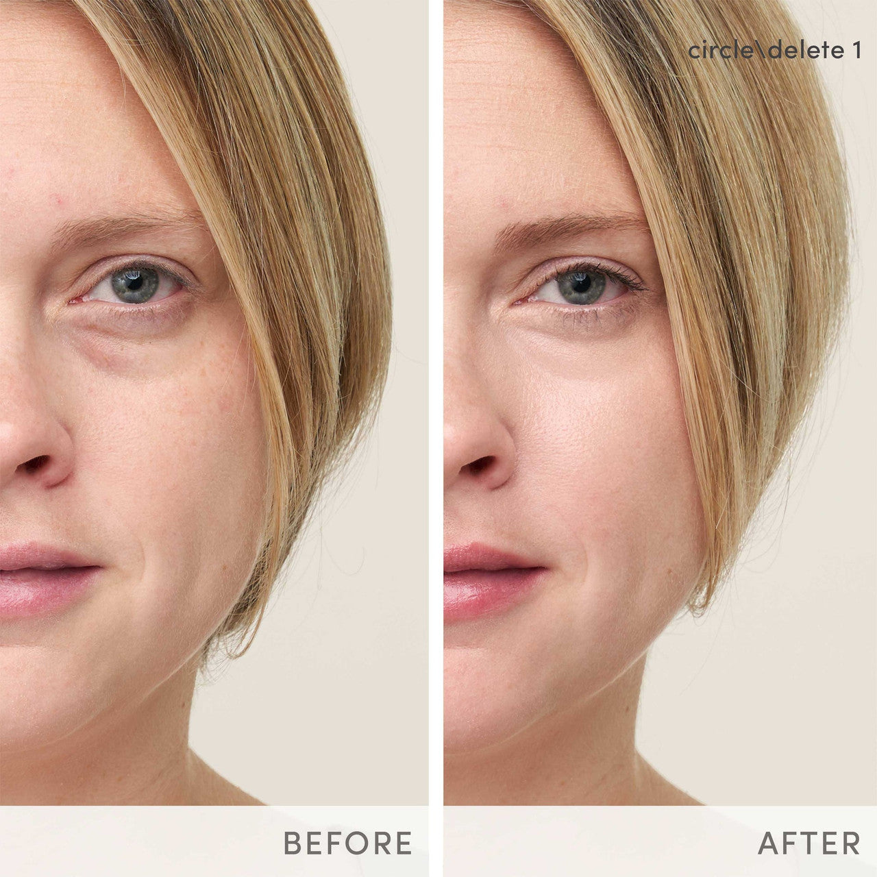 Jane Iredale Circle\Delete® Concealer - SkinElite - before and after