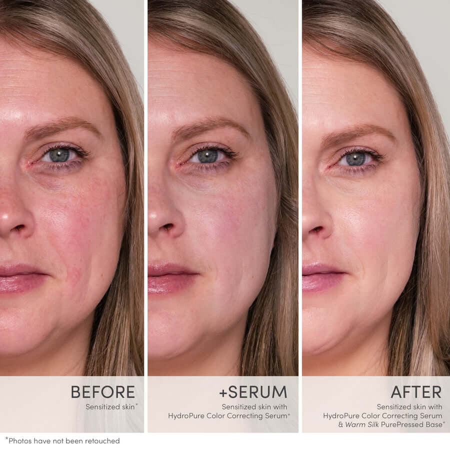 Jane Iredale HydroPure™ Color Correcting Serum with Hyaluronic Acid & CoQ10 - SkinElite - before and after 1