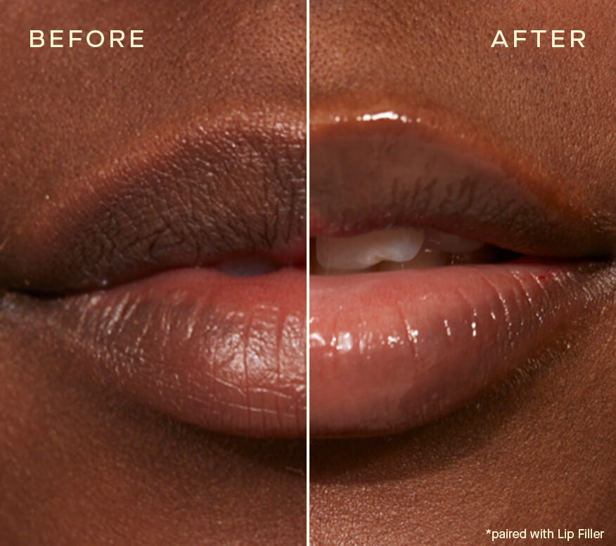Ourself Lip Plumping and Enhancing Duo - SkinElite - before and after 1