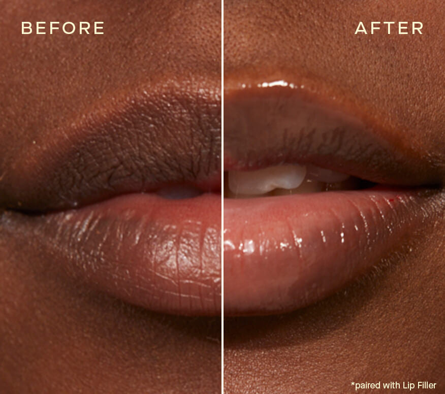 Ourself Lip Plumping and Enhancing Duo - SkinElite - before and after 1