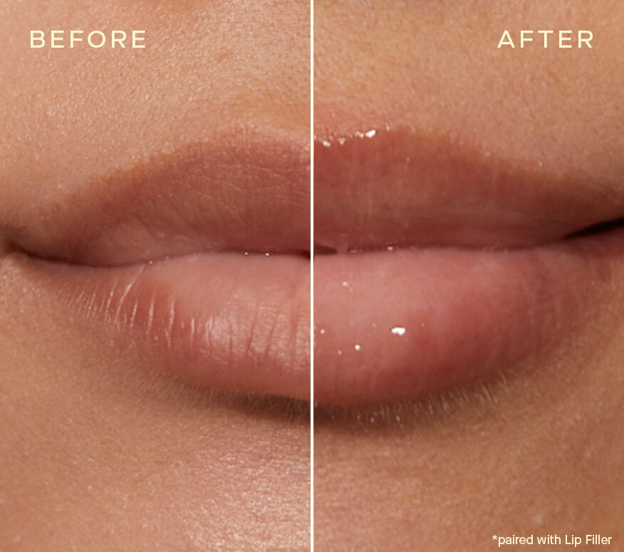 Ourself Lip Plumping and Enhancing Duo - SkinElite - before and after 2