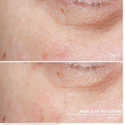 Doctor Babor Dual Eye Solution 1 fl oz - SkinElite - results