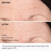 goop beauty 3x Retinol Regenerative Serum1 fl oz - Skin Elite - before and after