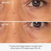 goop beauty 3x Retinol Eye Lift Serum 0.5 fl oz - Skin Elite - before and after