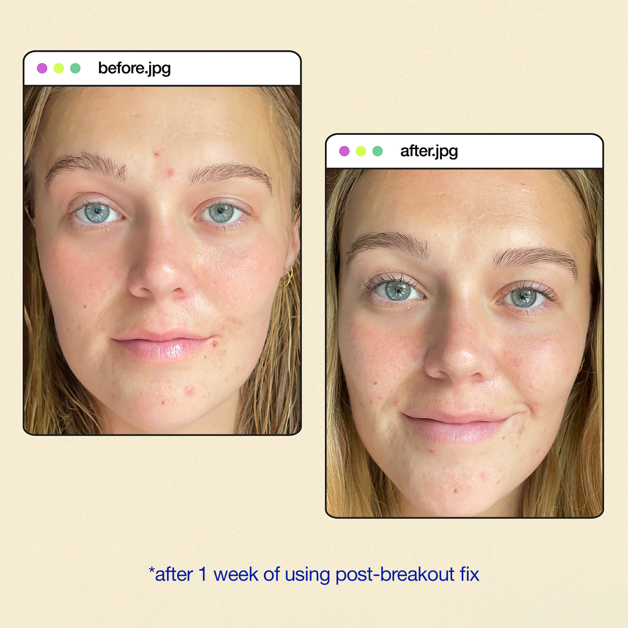 Dermalogica Clear Start Post-Breakout Fix 0.5 fl oz before & after