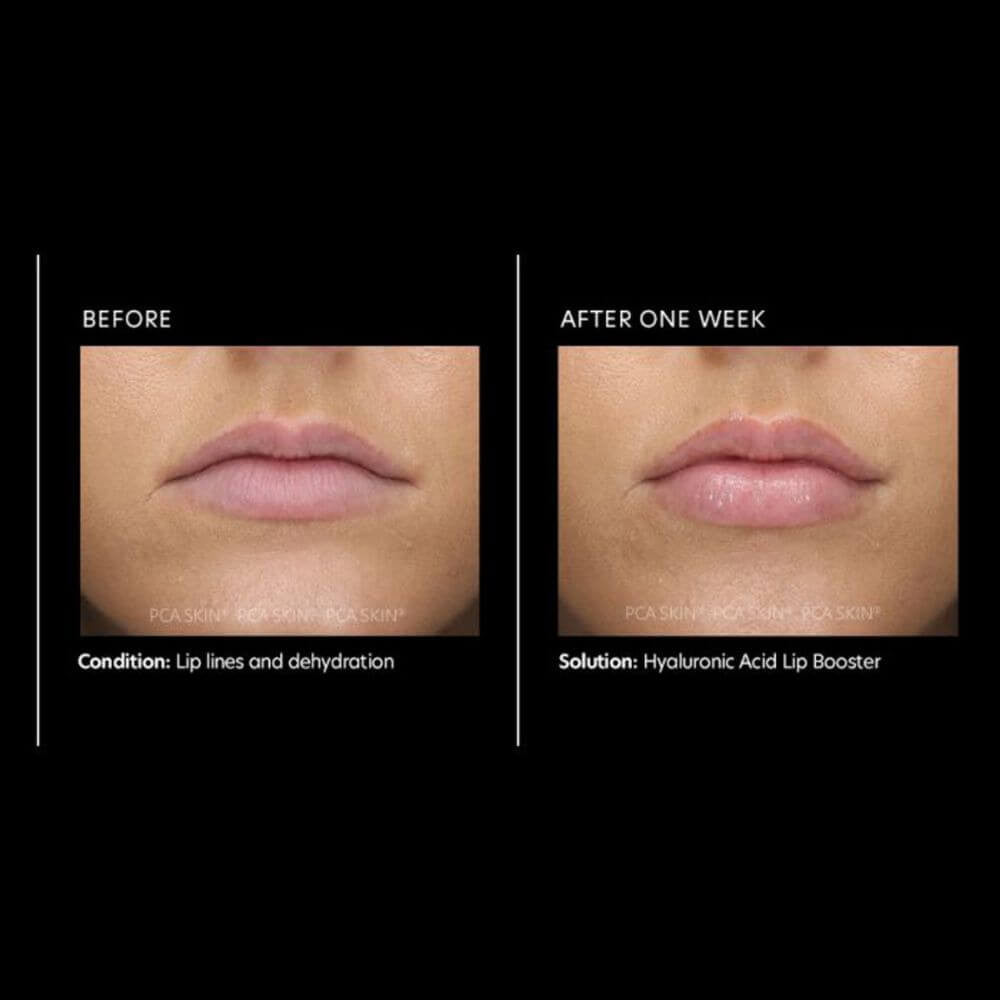 PCA Skin Hyaluronic Acid Lip Booster Before and After Results