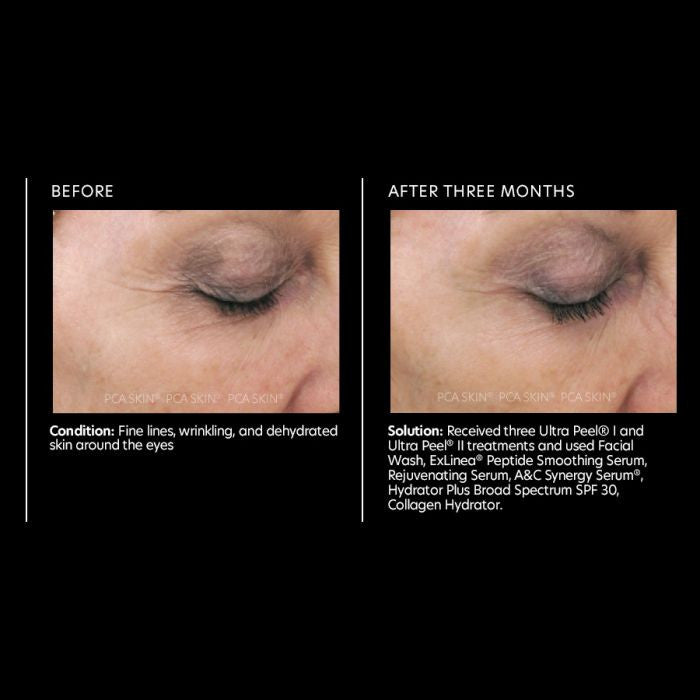 PCA Skin Rejuvenating Serum 1fl oz - results