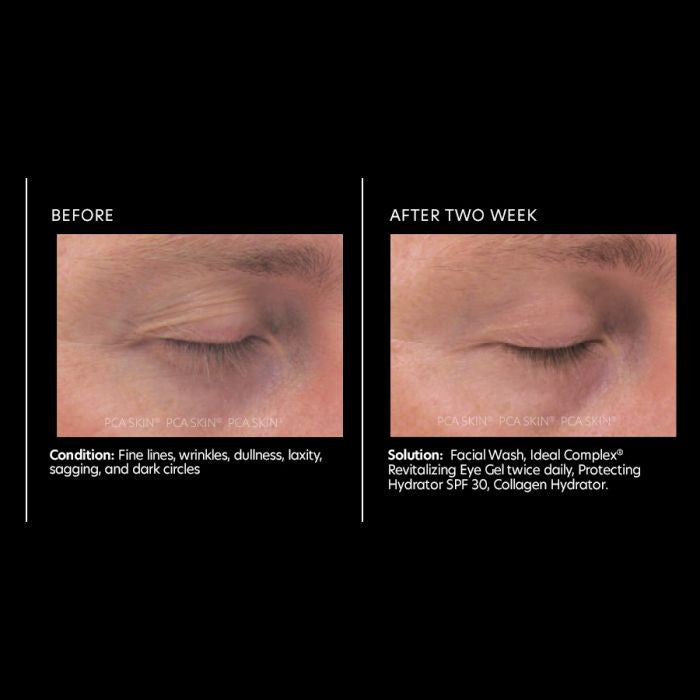 PCA Skin Ideal Complex Revitalizing Eye Gel 0.5fl oz - results