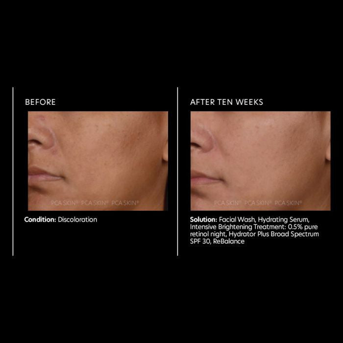 PCA Skin Intensive Brightening Treatment 1fl oz - results