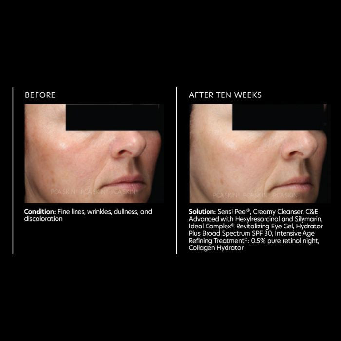 PCA Skin C&E advanced 1fl oz. - results