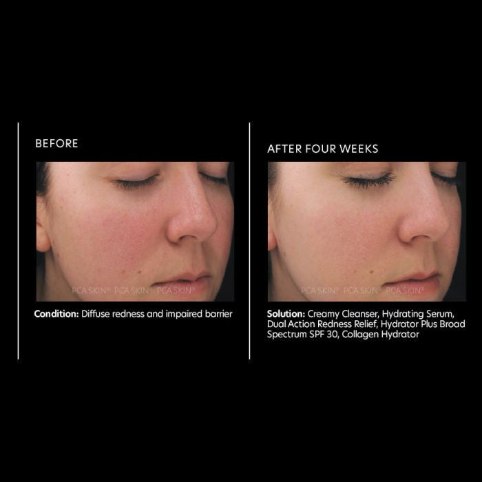 PCA Skin Dual Action Redness Relief 1fl oz - infographic 1