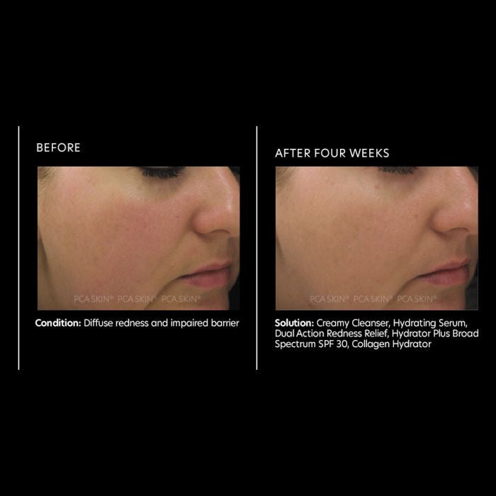 PCA Skin Dual Action Redness Relief 1fl oz - infographic 2