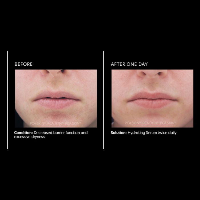 PCA Skin Hydrating Serum 1fl oz - results
