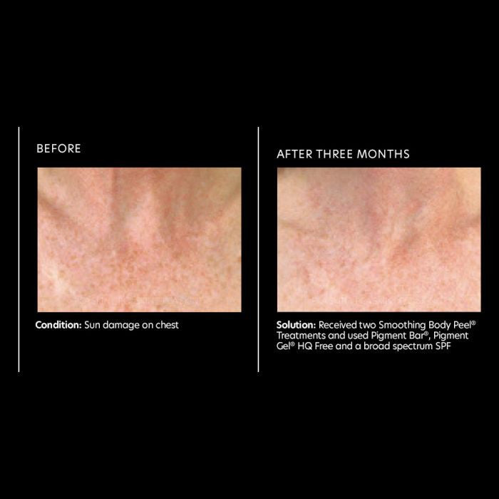 PCA Skin Pigment Bar 3.2fl oz - results